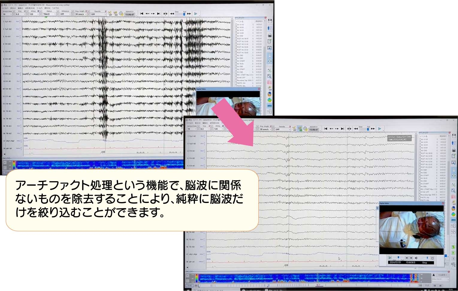 eeg-test_202410_04.jpg