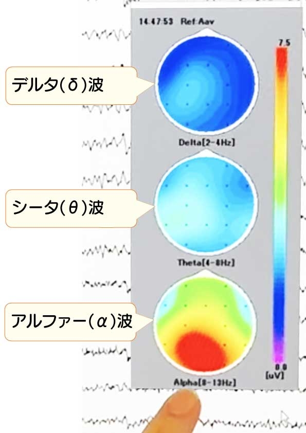 eeg-test_202410_05.jpg