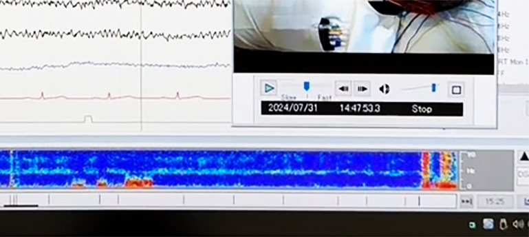 eeg-test_202410_06.jpg